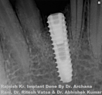 Magadh Oro Dental Implant and Orthodontic Clinic in Ramkrishna Nagar, Kankarbagh, Patna